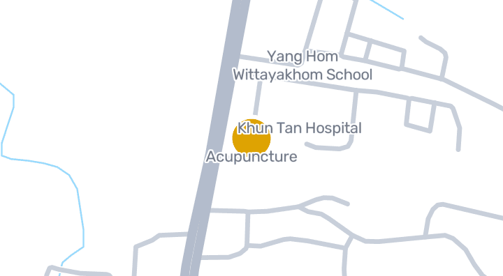 แผนที่แสดงAcupuncture